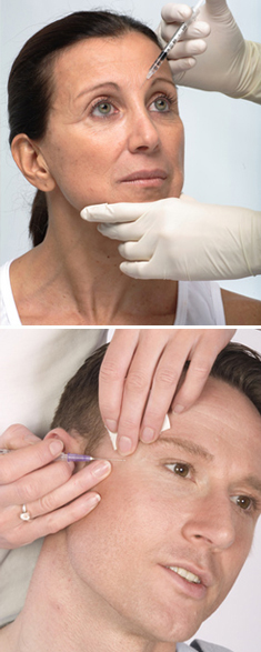 Botox- Behandlung Hautarzt Berlin